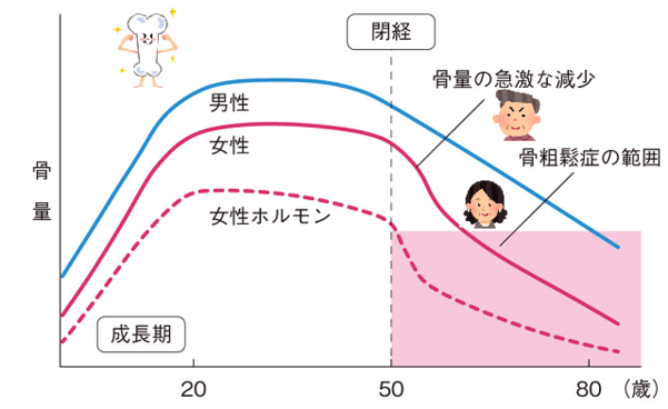 概念図：年齢と閉経に伴う骨量の変化