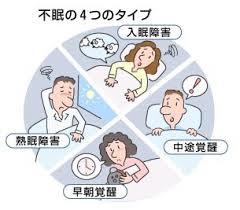 イラスト：4つのタイプの不眠
