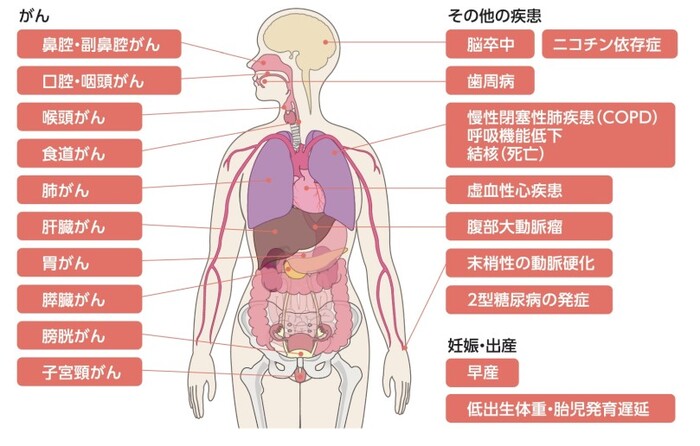 イラスト:喫煙している本人がなりやすい病気の種類